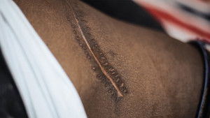 Exposing the Illegal Organ Trade